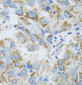 PSMD10 Rabbit Polyclonal Antibody
