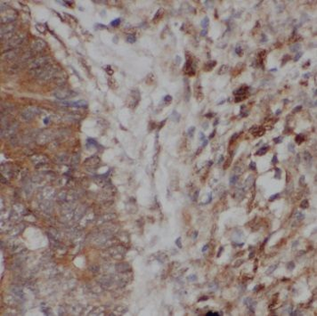 PSMD14 Antibody