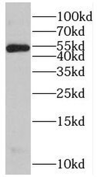 PSMD4 Rabbit Polyclonal Antibody