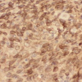 PSMD4 Rabbit Polyclonal Antibody