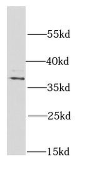 PSMD7 Rabbit Polyclonal Antibody