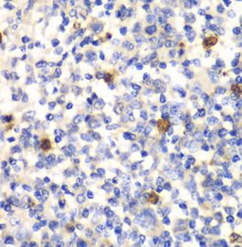 PSMD7 Rabbit Polyclonal Antibody