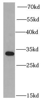 PSME2 Rabbit Polyclonal Antibody