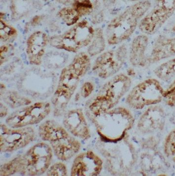 PSME2 Rabbit Polyclonal Antibody