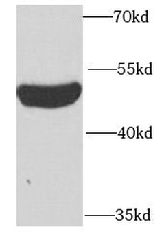 PSTPIP1 Rabbit Polyclonal Antibody