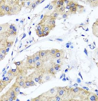 PSTPIP1 Rabbit Polyclonal Antibody