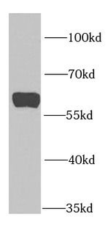 PTBP1 Rabbit Polyclonal Antibody