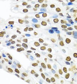 PTBP1 Rabbit Polyclonal Antibody