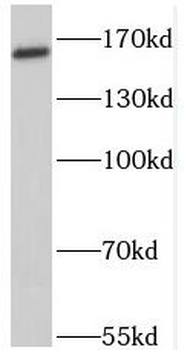 PTCH1 Rabbit Polyclonal Antibody