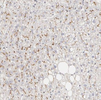 PTCH1 Rabbit Polyclonal Antibody