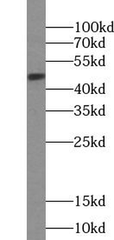 PTGER3 Rabbit Polyclonal Antibody