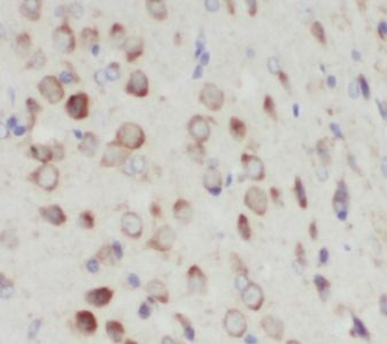 PTGER3 Rabbit Polyclonal Antibody