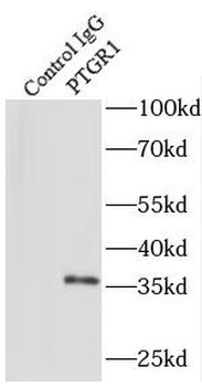 PTGR1 Antibody