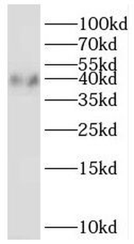 PTGR2 Rabbit Polyclonal Antibody
