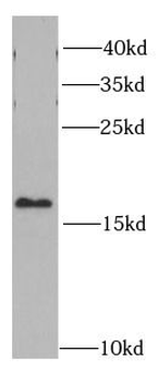 PTN Rabbit Polyclonal Antibody