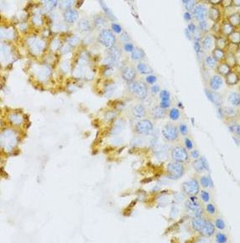PTN Rabbit Polyclonal Antibody
