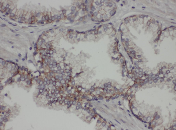 PTPN1 Rabbit Polyclonal Antibody