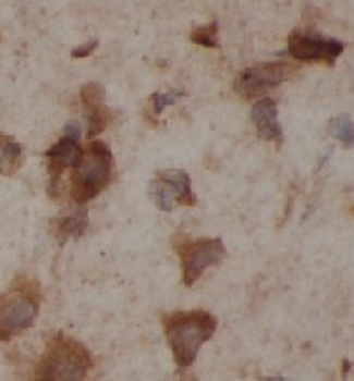 PTPN18 Rabbit Polyclonal Antibody