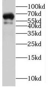 PTPN5 Rabbit Polyclonal Antibody