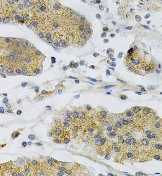 PTPRA Rabbit Polyclonal Antibody