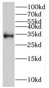 PTPRR Rabbit Polyclonal Antibody