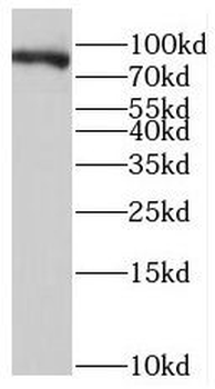 PTPRS Rabbit Polyclonal Antibody