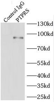 PTPRS Rabbit Polyclonal Antibody