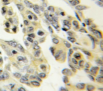 PTPRS Rabbit Polyclonal Antibody