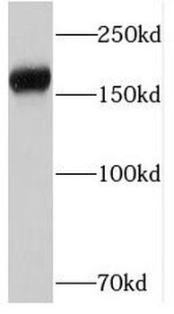 PTPRZ1 Rabbit Polyclonal Antibody