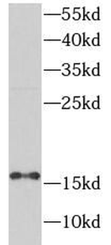 PTS Rabbit Polyclonal Antibody