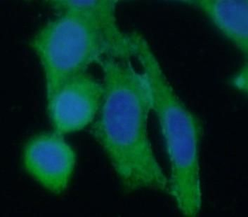 PTS Rabbit Polyclonal Antibody