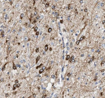 PTS Rabbit Polyclonal Antibody