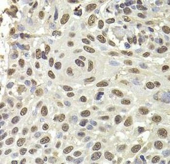 PUF60 Rabbit Polyclonal Antibody