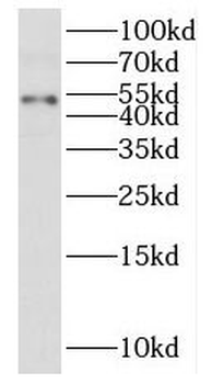 PUS3 Rabbit Polyclonal Antibody