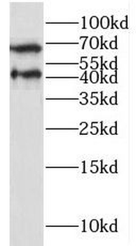 NECTIN4 Antibody