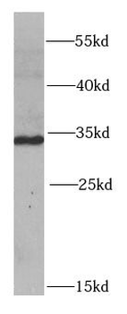 PYCR1 Rabbit Polyclonal Antibody