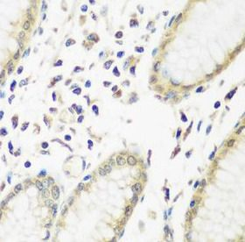 PYCR1 Rabbit Polyclonal Antibody