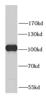 PYGB Rabbit Polyclonal Antibody
