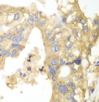 PYGB Rabbit Polyclonal Antibody