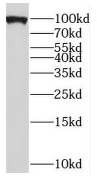 PYGB Rabbit Polyclonal Antibody