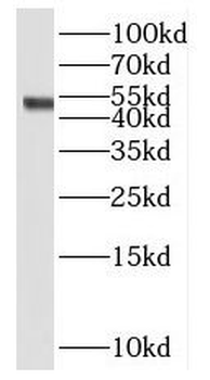 PYGO2 Rabbit Polyclonal Antibody