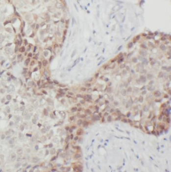 PYGO2 Rabbit Polyclonal Antibody