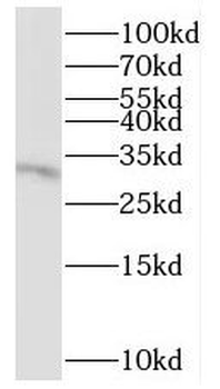 QPRT Rabbit Polyclonal Antibody