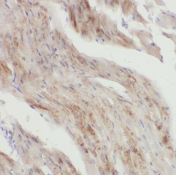 QSOX1 Rabbit Polyclonal Antibody