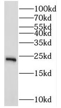 RAB10 Rabbit Polyclonal Antibody