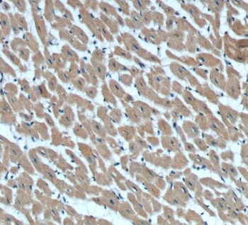 RAB11A Rabbit Polyclonal Antibody