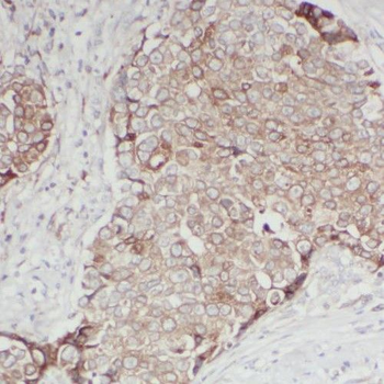 RAB11FIP1 Rabbit Polyclonal Antibody
