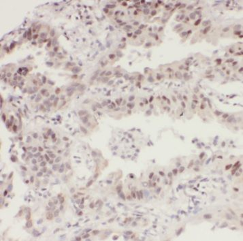 RAB1A Rabbit Polyclonal Antibody
