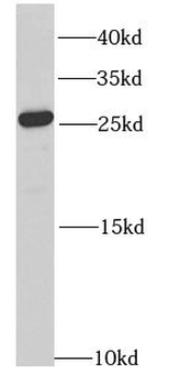 RAB27A Rabbit Polyclonal Antibody