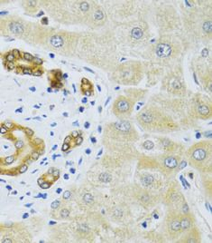 RAB27A Rabbit Polyclonal Antibody